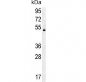 Western blot testing of human NCI-H460 cell lysate with DENND1B antibody. Predicted molecular weight: 34~87 kDa (multiple isoforms).