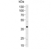 Western blot testing of human SH-SY5Y cell lysate with SERPINI1 antibody. Predicted molecular weight ~46 kDa.