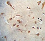 IHC testing of FFPE human brain tissue with SERPINI1 antibody. HIER: steam section in pH6 citrate buffer for 20 min and allow to cool prior to staining.
