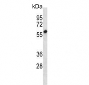 Western blot testing of mouse Neuro-2a cell lysate with SMYD2 antibody. Predicted molecular weight ~50 kDa.