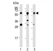 Western blot testing of 1) human HT-1080, 2) mouse heart and 3) human HeLa cell lysate with SMYD2 antibody. Predicted molecular weight ~50 kDa.