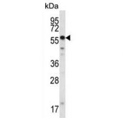 Western blot testing of human NCI-H292 cell lysate with SMYD2 antibody. Predicted molecular weight ~50 kDa.