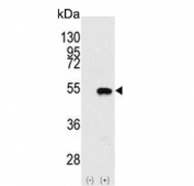 Western blot testing of 1) non-transfected and 2) transfected 293 cell lysate with SMYD2 antibody. Predicted molecular weight ~50 kDa.