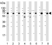 Western blot testing of human 1) HEK293, 2) RD, 3) Karpas 299, 4) Raji, 5) Jurkat, 6) HeLa, 7) HepG2 and 8) mouse NIH 3T3 cell lysate with IGF2BP1 antibody. Predicted molecular weight ~64 kDa.