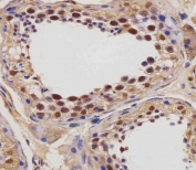IHC testing of FFPE human testis tissue with IGF2BP1 antibody. HIER: steam section in pH6 citrate buffer for 20 min and allow to cool prior to staining.
