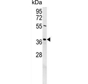 Western blot testing of mouse NIH 3T3 cell lysate with Exonuclease V antibody. Predicted molecular weight ~42 kDa.