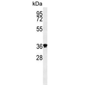 Western blot testing of human MDA-MB-453 cell lysate with Exonuclease V antibody. Predicted molecular weight ~42 kDa.
