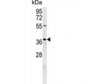 Western blot testing of mouse NIH 3T3 cell lysate with Exonuclease V antibody. Predicted molecular weight ~42 kDa.