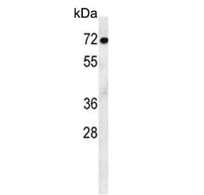 Western blot testing of mouse stomach lysate with ATF7IP2 antibody. Predicted molecular weight ~76 kDa.