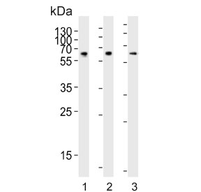 Western blot testing of human 1) HT-29, 2) ThP-1 and 3) cerebellum lysate with cGAMP Synthase antibody. Predicted molecular weight ~59 kDa.