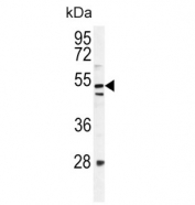 Western blot testing of mouse NIH 3T3 cell lysate with MEAK7 antibody. Predicted molecular weight ~51 kDa.