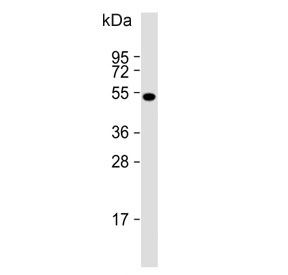 Western blot testing of human DU145 cell lysate with MEAK7 antibody. Predicted molecular weight ~51 kDa.