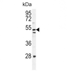 Western blot testing of mouse NIH 3T3 cell lysate with MEAK7 antibody. Predicted molecular weight ~51 kDa.