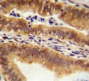 IHC testing of FFPE human uterus tissue with MEAK7 antibody. HIER: steam section in pH6 citrate buffer for 20 min and allow to cool prior to staining.