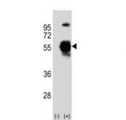 Western blot testing of 1) non-transfected and 2) transfected 293 cell lysate with UBA3 antibody. Predicted molecular weight ~52 kDa.
