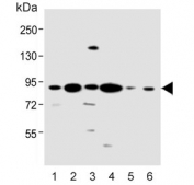 Western blot testing of human 1) HeLa, 2) MCF7, 3) HL60, 4) Jurkat, 5) K562 and 6) SH-SY5Y cell lysate with CCNT1 antibody. Predicted molecular weight ~81 kDa.