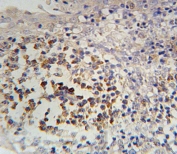 IHC testing of FFPE human tonsil tissue with IL12RB2 antibody. HIER: steam section in pH6 citrate buffer for 20 min and allow to cool prior to staining.