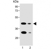 Western blot testing of human 1) 293T and 2) A549 cell lysate with Folate Receptor alpha antibody. Predicted molecular weight ~30 kDa but may be observed at higher molecular weights due to glycosylation.