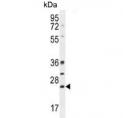Western blot testing of mouse spleen lysate with BCL10 antibody. Observed molecular weight: 26~33 kDa.