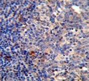 IHC testing of FFPE human tonsil tissue with BCL10 antibody. HIER: steam section in pH6 citrate buffer for 20 min and allow to cool prior to staining.