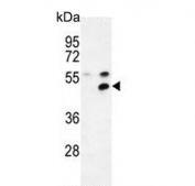 Western blot testing of 1) non-transfected and 2) transfected 293 cell lysate with MPP1 antibody. Expected molecular weight 52-55 kDa.