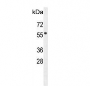 Western blot testing of human HeLa cell lysate with FBXW8 antibody. Predicted molecular weight ~67 kDa.