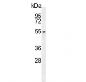 Western blot testing of mouse bladder tissue lysate with FBXW8 antibody. Predicted molecular weight ~67 kDa.