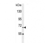 Western blot testing of mouse kidney tissue lysate with BUD13 antibody. Predicted molecular weight ~71 kDa.