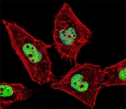 Immunofluorescent staining of fixed and permeabilized human HeLa cells with ROR alpha antibody (green), DAPI nuclear stain (blue) and anti-Actin (red).