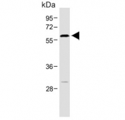 Western blot testing of human brain lysate with ROR alpha antibody. Predicted molecular weight ~59 kDa.