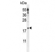 Western blot testing of human K562 cell lysate with IQCJ antibody. Predicted molecular weight ~18 kDa.