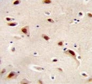IHC testing of FFPE human brain tissue with IQCJ antibody. HIER: steam section in pH6 citrate buffer for 20 min and allow to cool prior to staining.