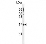 Western blot testing of mouse NIH 3T3 cell lysate with IQCJ antibody. Predicted molecular weight ~18 kDa.