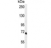 Western blot testing of human MDA-MB-435 cell lysate with VPS52 antibody. Predicted molecular weight ~82 kDa (isoform 1) and 68 kDa (isoform 2).