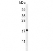 Western blot testing of human K562 cell lysate with RPL27A antibody. Predicted molecular weight ~17 kDa.