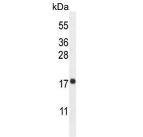 Western blot testing of human K562 cell lysate with RPL27A antibody. Predicted molecular weight ~17 kDa.