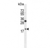 Western blot testing of hamster CHO cell lysate with RPL27A antibody. Predicted molecular weight ~17 kDa.