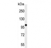 Western blot testing of mouse kidney lysate with Estrogen-induced gene 121-like protein antibody. Predicted molecular weight ~114 kDa.