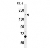 Western blot testing of human A549 cell lysate with TDRD7 antibody. Expected molecular weight: 124-160 kDa.