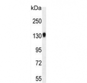 Western blot testing of mouse bladder tissue lysate with TDRD7 antibody. Expected molecular weight: 124-160 kDa.