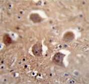 IHC testing of FFPE human brain tissue with TDRD7 antibody. HIER: steam section in pH6 citrate buffer for 20 min and allow to cool prior to staining.