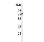 Western blot testing of human A549 cell lysate with FBX24 antibody. Predicted molecular weight: 36-69 kDa (multiple isoforms).