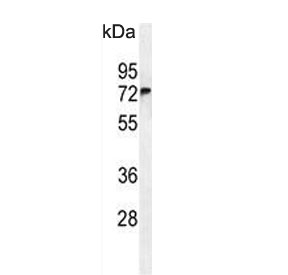 Western blot testing of human A549 cell lysate with FBX24 antibody. Predicted molecular weight: 36-69 kDa (multiple isoforms).