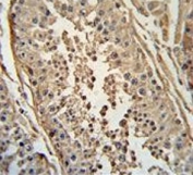 IHC testing of FFPE human testis tissue with FBX24 antibody. HIER: steam section in pH6 citrate buffer for 20 min and allow to cool prior to staining.