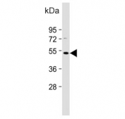 Western blot testing of human Caco-2 cell lysate with OTUD3 antibody. Predicted molecular weight ~45 kDa.