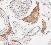 IHC testing of FFPE human testis tissue with OTUD3 antibody. HIER: steam section in pH6 citrate buffer for 20 min and allow to cool prior to staining.