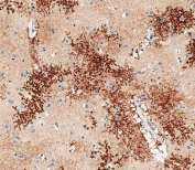 IHC testing of FFPE human brain tissue with OTUD3 antibody. HIER: steam section in pH6 citrate buffer for 20 min and allow to cool prior to staining.