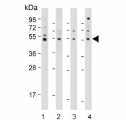 Western blot testing of human 1) LNCaP, 2) RD, 3) HEK293 and 4) U-251 MG cell lysate with OTUD3 antibody. Predicted molecular weight ~45 kDa.