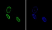 Immunofluorescent staining of human HepG2 cells with NR0B2 antibody (green) and DAPI nuclear stain (blue).