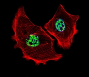 Immunofluorescent staining of fixed and permeabilized human SK-BR-3 cells with Upstream stimulatory factor 1 antibody (green), DAPI nuclear stain (blue) and anti-Actin (red).